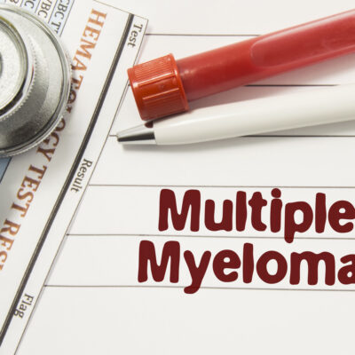 Treatments for Multiple Myeloma