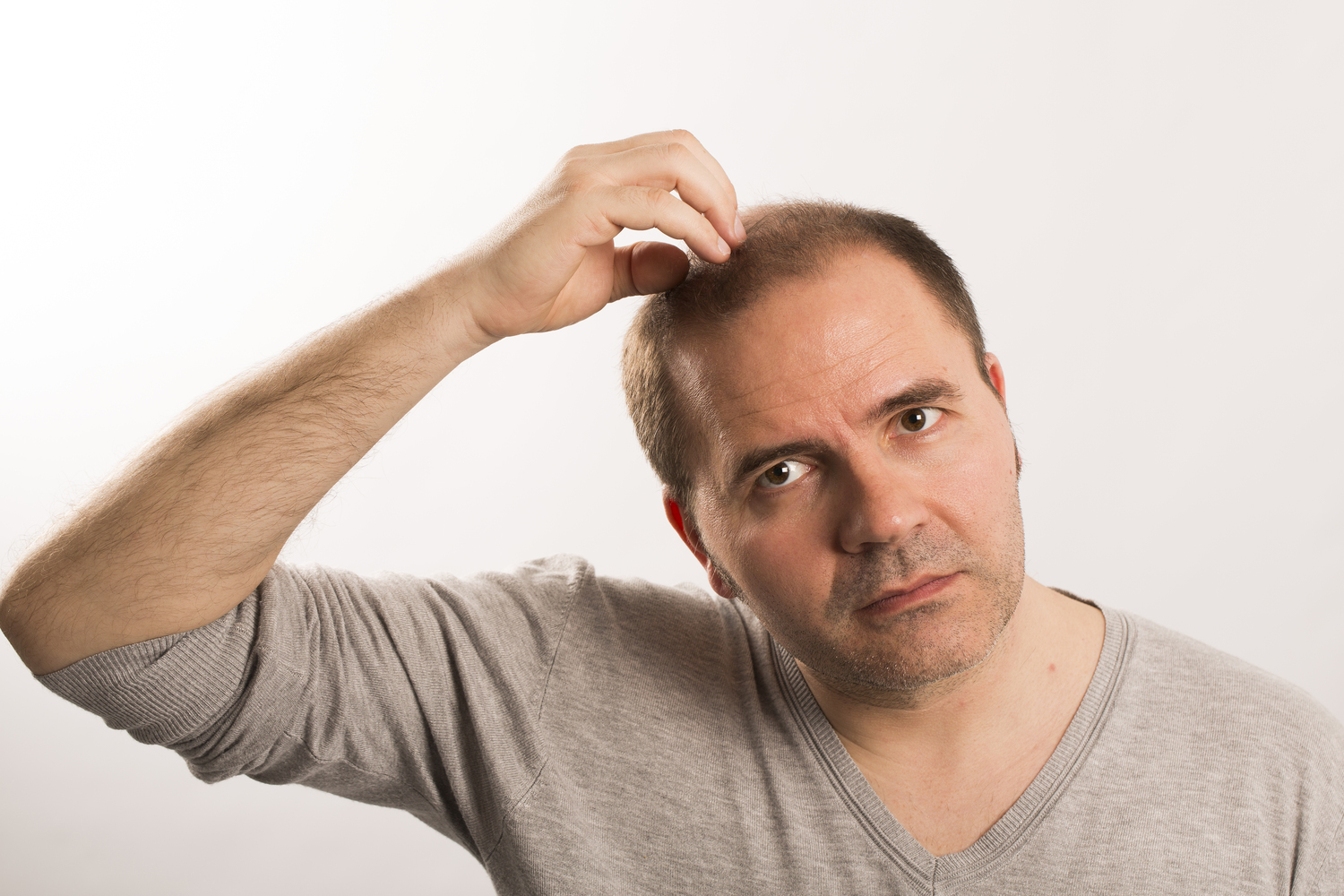 Proven Tips to Treat Male Pattern Baldness