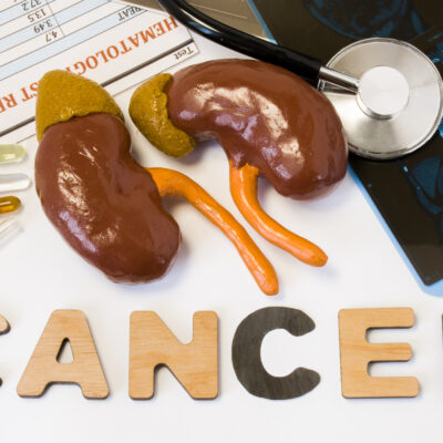 Treating Kidney Cancer