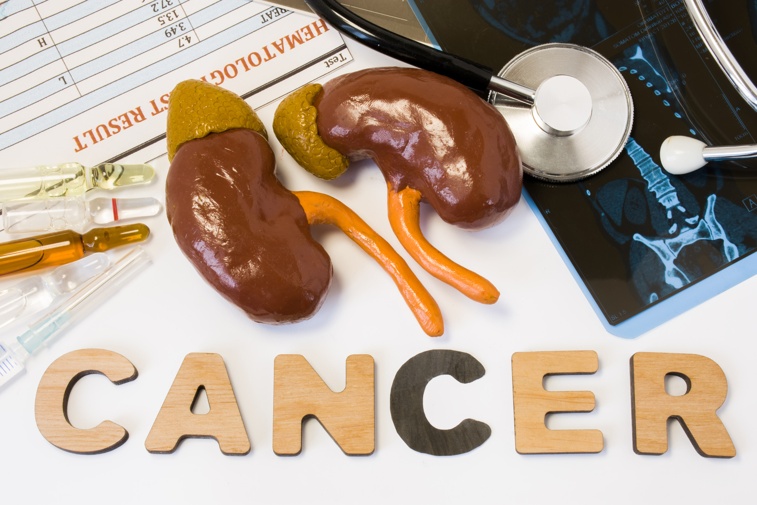 Treating Kidney Cancer