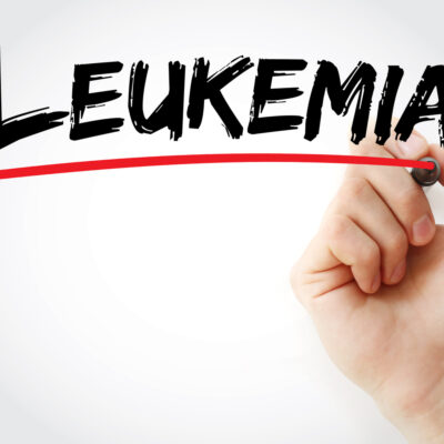 Causes and Types of Leukemia