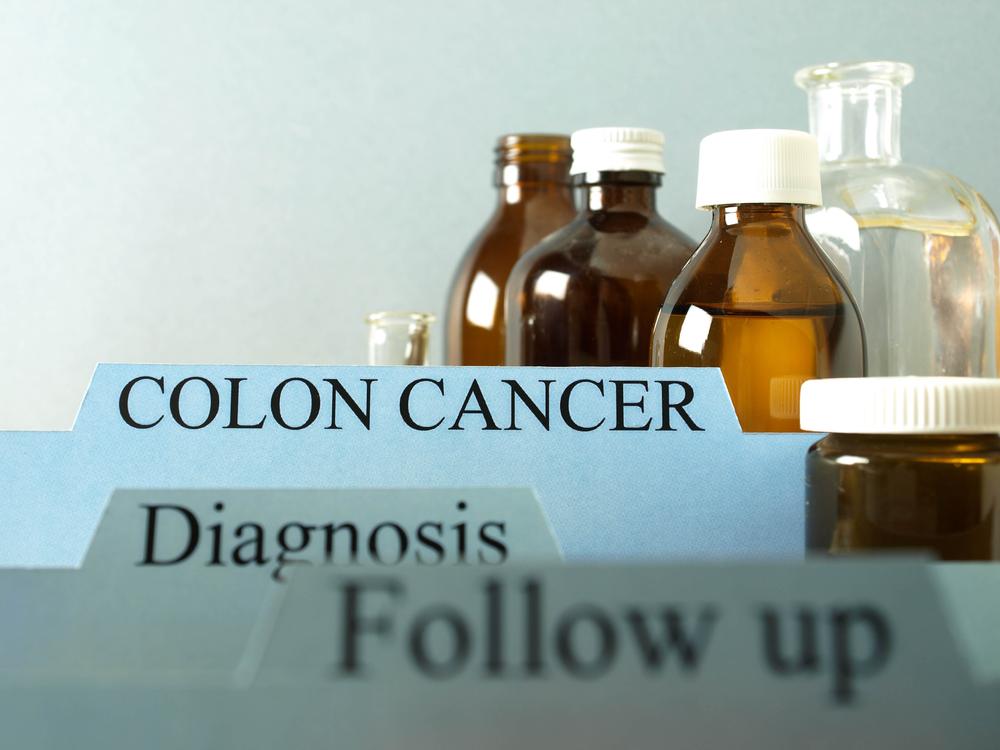 Effective Colon Cancer Treatment Options