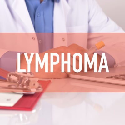 How To Treat and Manage Lymphoma