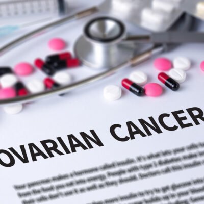 Ovarian Cancer: Types and Treatment