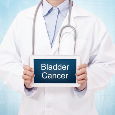 Bladder Cancer Diagnosis, Staging, and Treatment