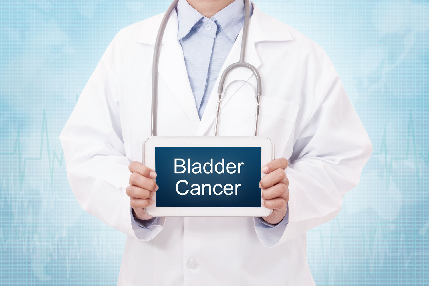 Bladder Cancer Diagnosis, Staging, and Treatment